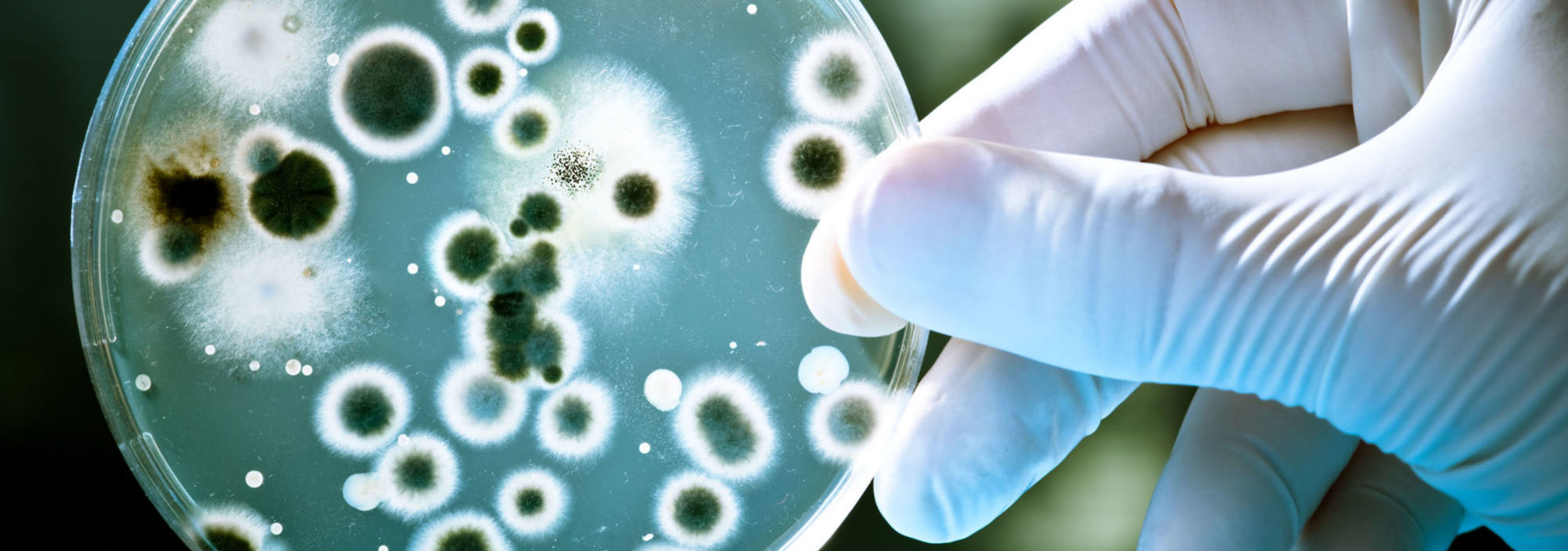 Harrington Discovery Institute Accelerates Breakthrough Science into Cancer Treatments and Cures. Harrington Advances Science to Medicine through Philanthropy. The image portrays a petri dish held by a gloved hand.